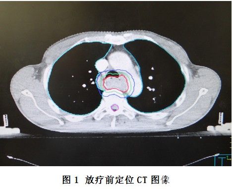 0f16bee3e7c7293b13f9dab4c60f4042.jpg 10.jpg..jpg