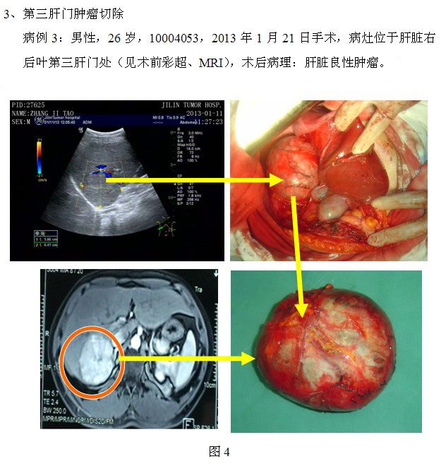 13c7a2a2d2cb1a76245e2035c2a6b8ca.jpg 10.jpg..jpg