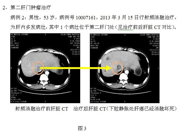5c8d84cc08e8a0ac7dec293ff89cf1f0.jpg 10.jpg..jpg