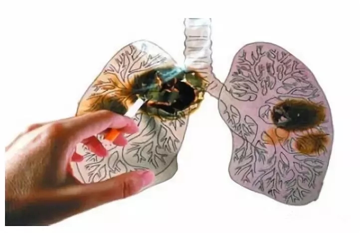 2481b85818c49b1f95067638a9034038.jpg 640.webp.jpg