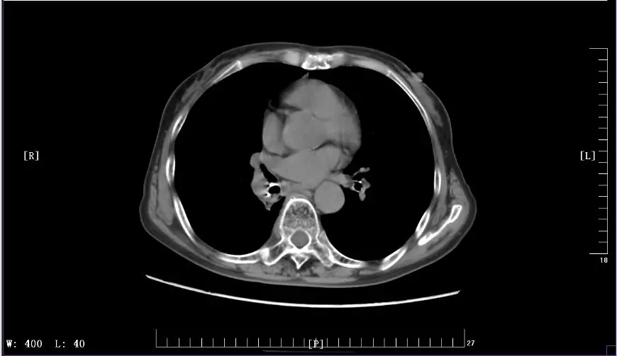 429cc8b19fe0fbf2ffb2ce4e71fb1f93.jpg 640.webp (4).jpg