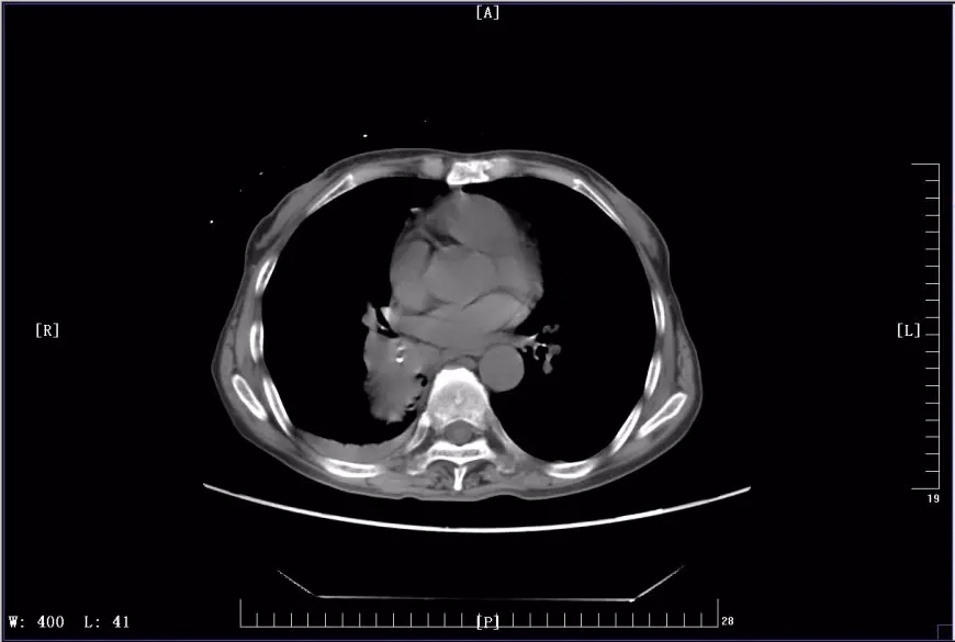 5f8909a5e8f1d83faa94e62773a6c1c6.jpg 640.webp.jpg